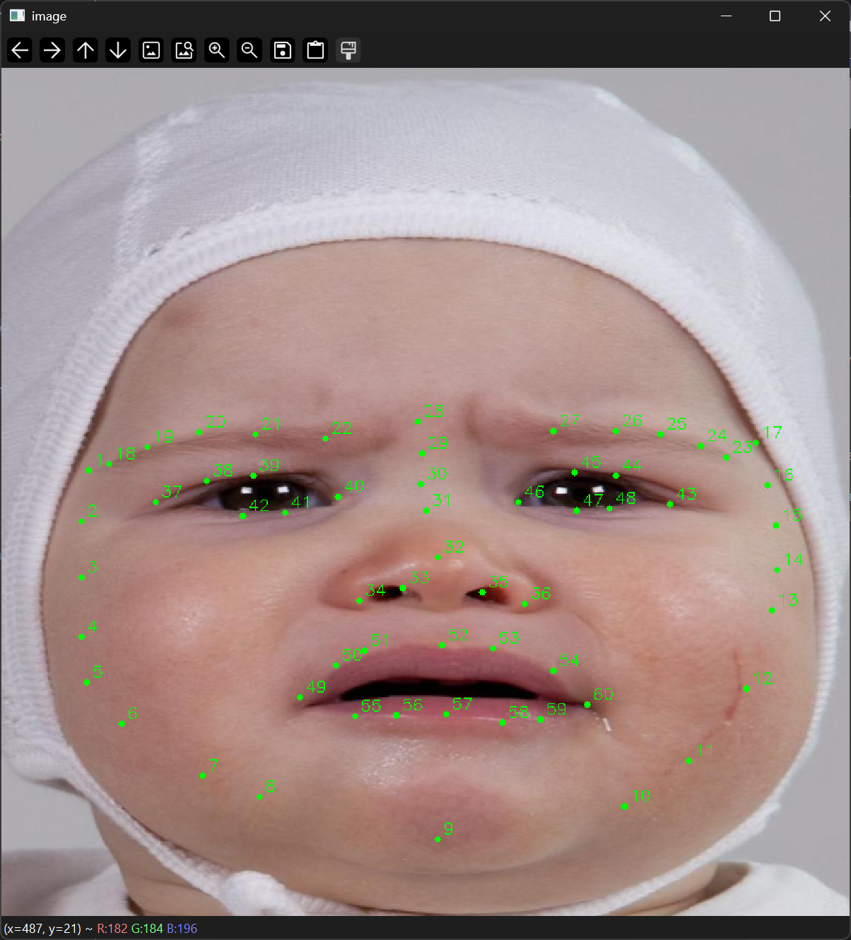 Infant face with facial landmarks